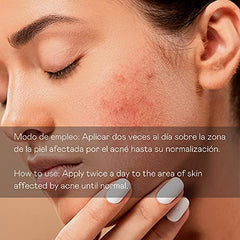 D´ Bullon Serum Facial Concentrado Especial Anti-acné Directo, Acción Intensiva. Vegano. Combate el acne y granos. Con Aloe Vera. Eliminar rápido el acné - 30 ml